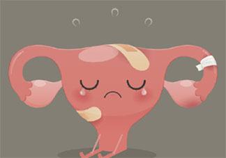 約70%卵巢癌患者發(fā)現(xiàn)就是晚期是為什么 卵巢癌早期有哪些癥狀表現(xiàn)