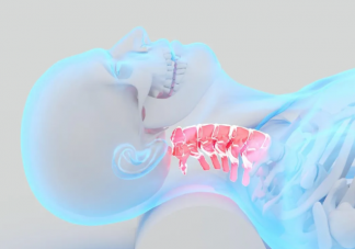 怎么判斷自己有沒有頸椎反弓 如何預防頸椎反弓