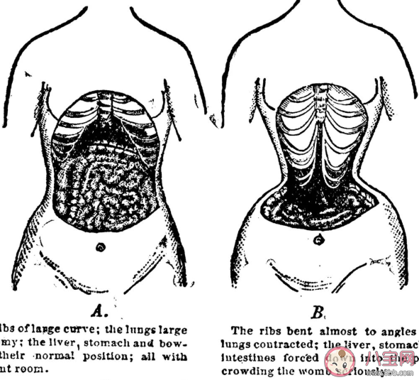 束腰減肥有效果嗎 束腰顯瘦的原理是什么 束腰減肥有效果嗎 束腰顯瘦的原理是什么