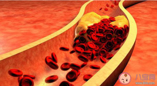 肥胖的人才會得高血脂瘦人不會這種說法 螞蟻莊園今日5月18日答案 肥胖的人才會得高血脂瘦人不會這種說法 螞蟻莊園今日5月18日答案