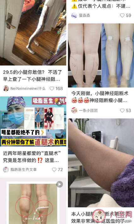 小腿肌肉阻斷術瘦腿原理是什么 小腿肌肉阻斷術有什么危害