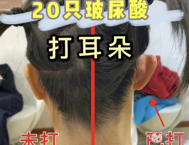 精靈耳是什么樣的 為什么精靈耳能如此受歡迎