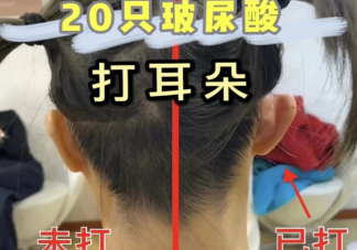 精靈耳是什么樣的 為什么精靈耳能如此受歡迎