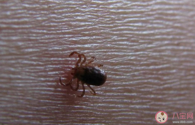 發(fā)現(xiàn)被蜱蟲咬了怎么辦 如何避免被蜱蟲叮咬