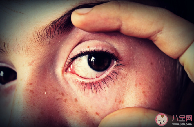 螞蟻莊園6月10日問題答案：只有老年人才會得白內障嗎