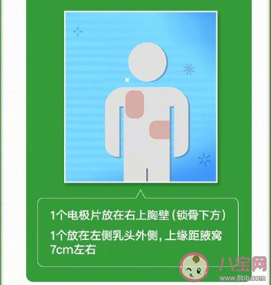 怎樣使用AED設備 正確使用AED設備方法 怎樣使用AED設備 正確使用AED設備方法
