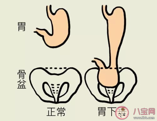 螞蟻莊園飯后立即運(yùn)動(dòng)會(huì)導(dǎo)致胃下垂這種說法 小課堂6月17日答案