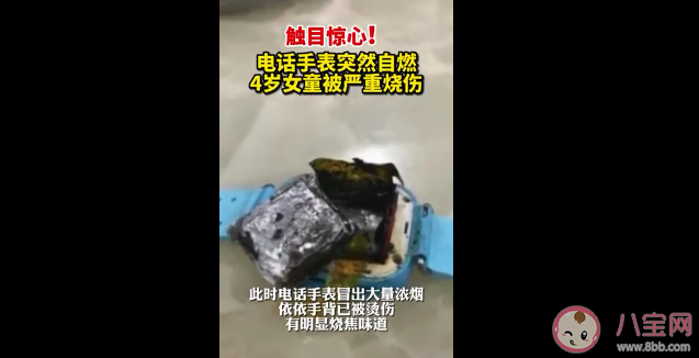電話手表自燃4歲女童手背被燒傷是怎么回事 電話手表為什么會自燃