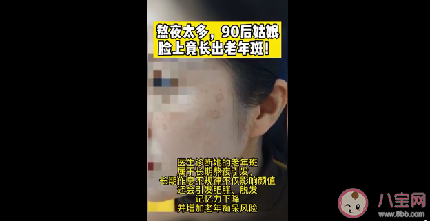 90后姑娘熬夜10年長出老年斑 避免熬夜老年斑能消除嗎