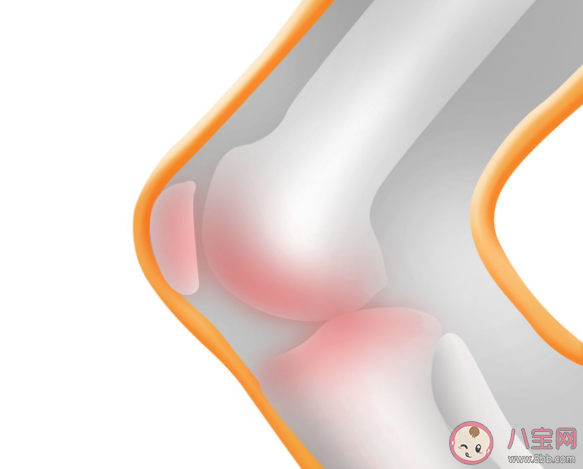 骨質(zhì)疏松真的和缺鈣有關嗎 骨質(zhì)疏松和哪些因素有關