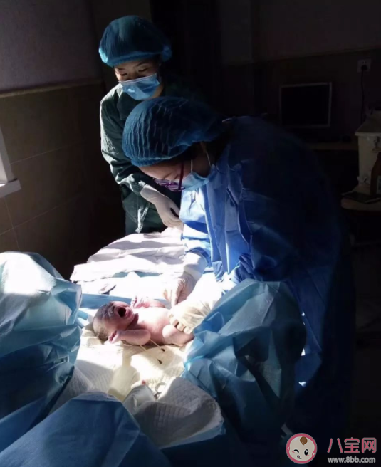 生孩子時(shí)為什么是頭先出來 生孩子為什么會(huì)順轉(zhuǎn)剖