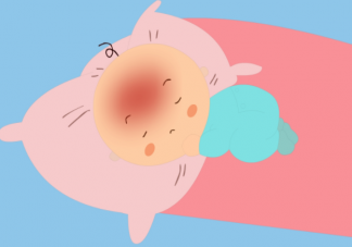 孩子中暑的正確做法是什么 孩子中暑要避開3大誤區