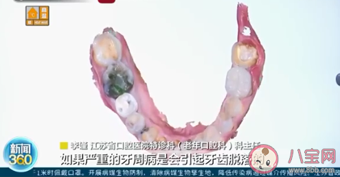 專家稱老了未必掉牙 掉牙是什么原因導致的