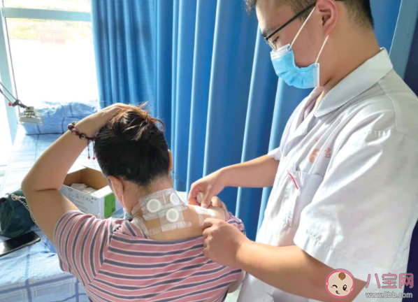 三伏貼貼敷后皮膚有哪些反應 三伏貼能代替治療嗎