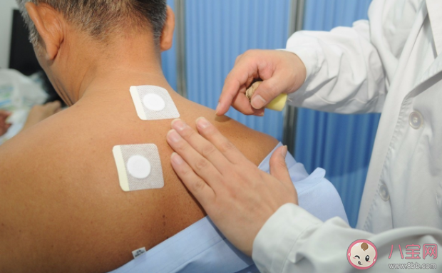 三伏貼貼敷后皮膚有哪些反應 三伏貼能代替治療嗎