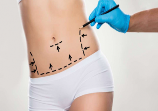 抽脂手術有什么風險 壞死性筋膜炎有多危險