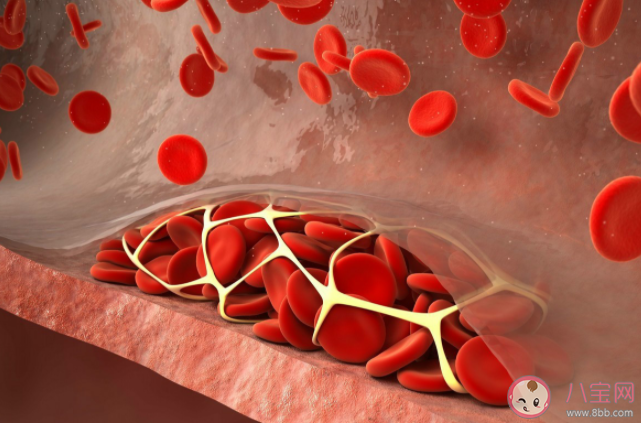 吃肉會升高血脂嗎 高血脂的人怎么健康合理吃肉