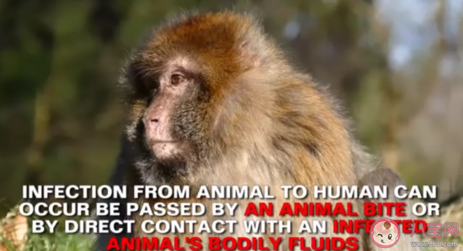 美國近20年來出現(xiàn)首例猴痘病毒病例 猴痘病毒有什么癥狀表現(xiàn)