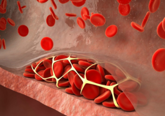 吃肉會升高血脂嗎 高血脂的人怎么健康合理吃肉