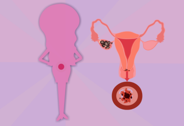 宮頸管多長比較正常 宮頸管篩查孕多少周檢查