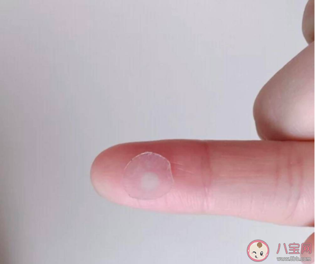 痘痘貼對痘痘有效果嗎 痘痘貼的適合什么人群 痘痘貼對痘痘有效果嗎 痘痘貼的適合什么人群