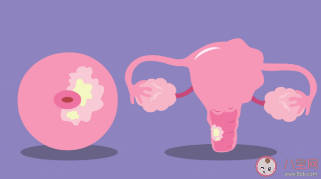 宮頸糜爛會(huì)危害身體健康嗎 宮頸糜爛會(huì)有哪些危害