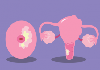 宮頸糜爛會危害身體健康嗎 宮頸糜爛會有哪些危害