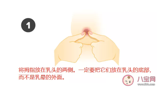 乳頭內陷怎么治療 不同程度乳頭內陷怎么矯正