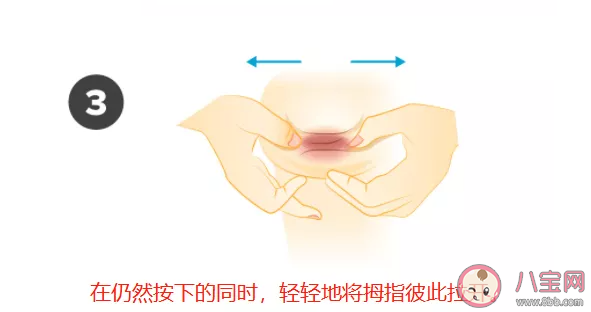 乳頭內陷怎么治療 不同程度乳頭內陷怎么矯正