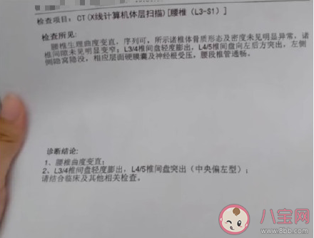 側(cè)臥睡帶來的危害是什么 10種疾病的專屬睡姿