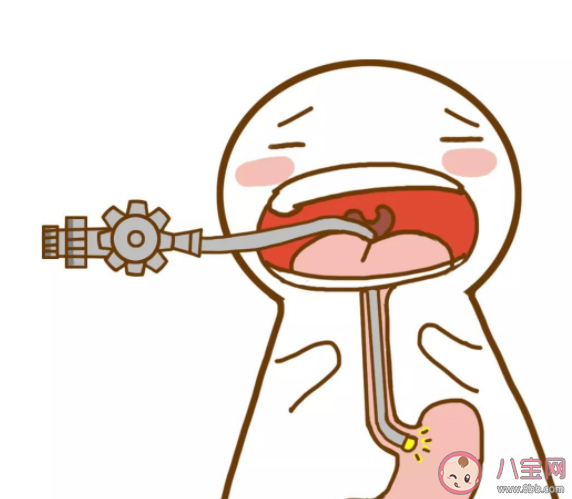 無痛胃腸鏡安全嗎 做完無痛胃腸鏡要留院觀察嗎