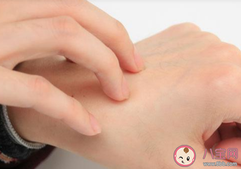 被蚊子咬了用指甲在蚊子包上畫十字止癢是好方法嗎 螞蟻莊園8月15日答案