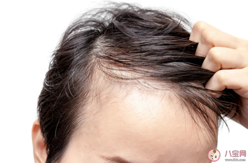 所有脫發人士都適合做植發手術嗎 螞蟻莊園8月16日正確答案