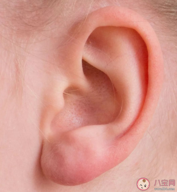 蟲子進了耳朵用手電筒照是好辦法嗎 螞蟻莊園8月19日正確答案 蟲子進了耳朵用手電筒照是好辦法嗎 螞蟻莊園8月19日正確答案