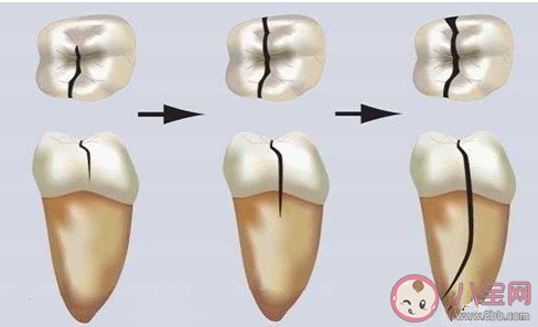 螞蟻莊園蟲牙是因為牙齒中有蟲嗎 8月20日答案介紹 螞蟻莊園蟲牙是因為牙齒中有蟲嗎 8月20日答案介紹