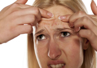 人為什么會長痘痘 長了痘痘一定要注意的8件事