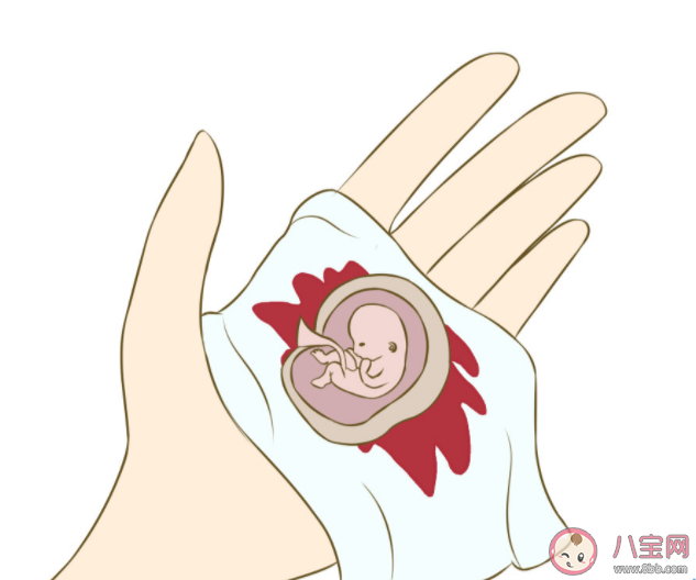 孕早期反復流產都是女方的問題嗎 反復流產后就不能懷孕了嗎