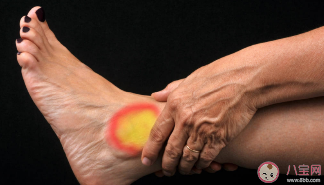 扭傷都可以用紅花油嗎 扭傷是該熱敷還是冷敷