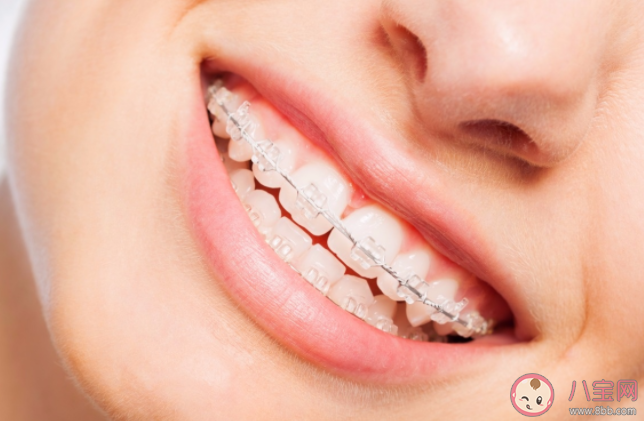 為什么戴牙套很久還是沒變化 戴牙套需不需要忌口 為什么戴牙套很久還是沒變化 戴牙套需不需要忌口