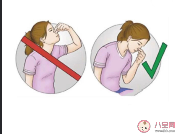 流鼻血時(shí)最科學(xué)合理的止血方式是什么 哪些方法不建議采用