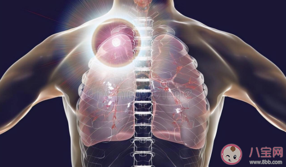 肺結(jié)節(jié)和肺癌有什么關(guān)系 為什么發(fā)現(xiàn)肺結(jié)節(jié)的人越來越多 肺結(jié)節(jié)和肺癌有什么關(guān)系 為什么發(fā)現(xiàn)肺結(jié)節(jié)的人越來越多