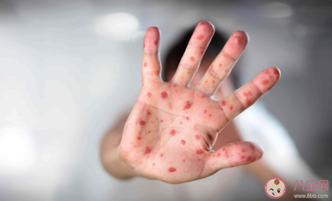 中秋國慶假期健康方面需注意哪些 中秋國慶出行個人防控五點建議 中秋國慶假期健康方面需注意哪些 中秋國慶出行個人防控五點建議