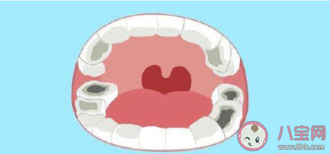 蛀牙真的和吃糖有關(guān)嗎 如何防止蛀牙