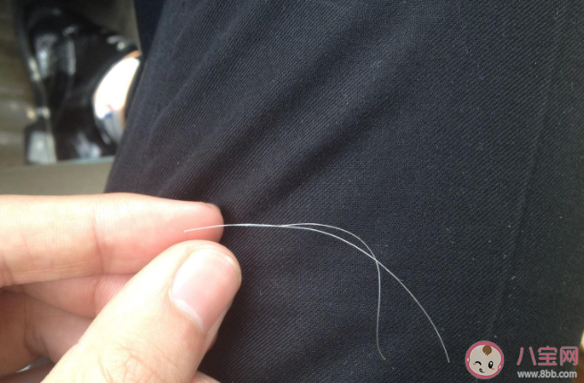 白頭發如何緩解或減少 哪些原因頭發會變白