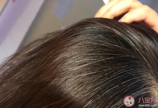 白頭發如何緩解或減少 哪些原因頭發會變白