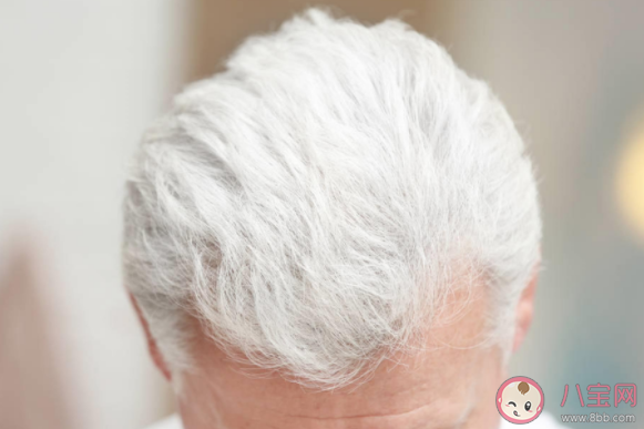 年紀輕輕就長白頭發(fā)正常嗎 怎么讓自己頭發(fā)沒那么快白