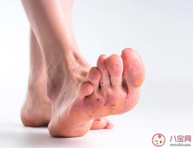 天天洗腳換襪子為什么還是腳臭 如何處理及預防腳臭