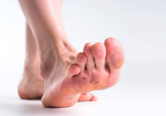 天天洗腳換襪子為什么還是腳臭 如何處理及預防腳臭