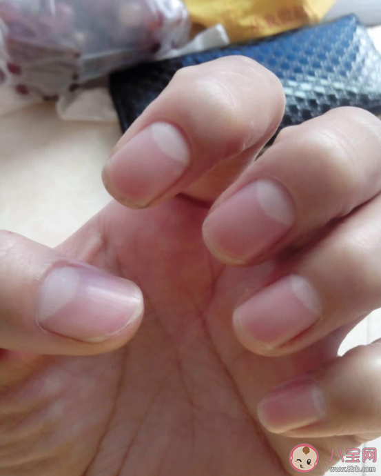 指甲上的白月牙是什么 指甲沒有月牙是身體不好的象征嗎