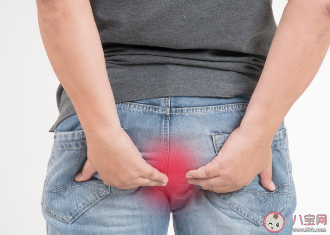 爸媽有痔瘡會遺傳嗎 痔瘡能根治嗎